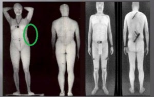 tsa body scanner